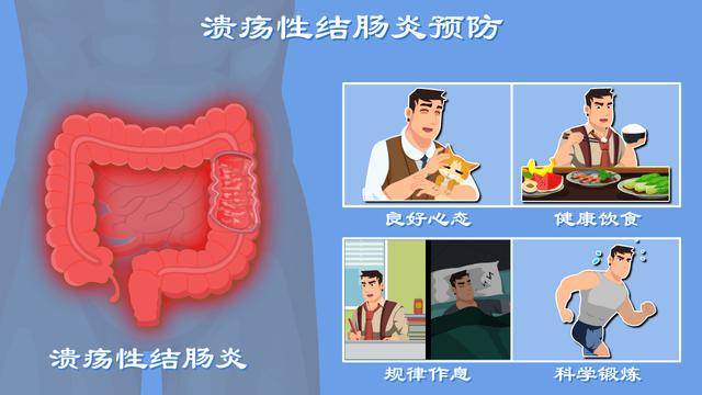 溃疡性结肠炎最新的治疗办法-溃疡性结肠炎治疗新进展解析